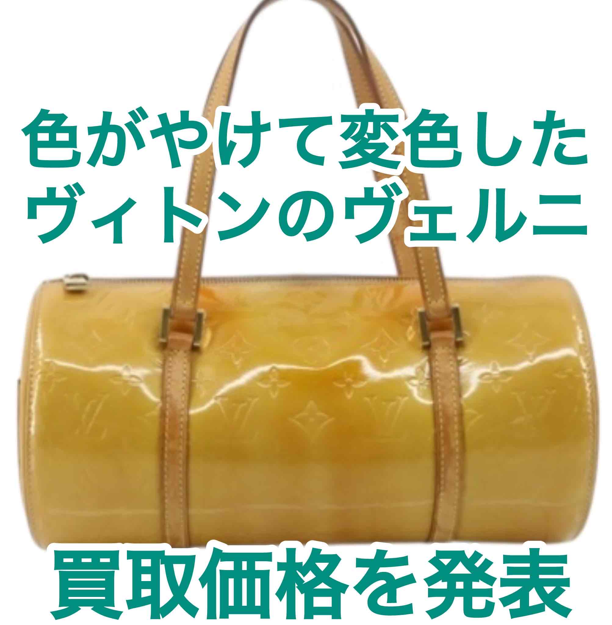 ヴィトン ヴェルニの変色バッグ】古くても高価買取｜ベタつきありの 